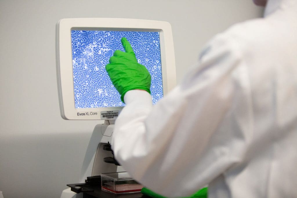 A hand in a green rubber glove pointing to cells on a magnifying glass screen
