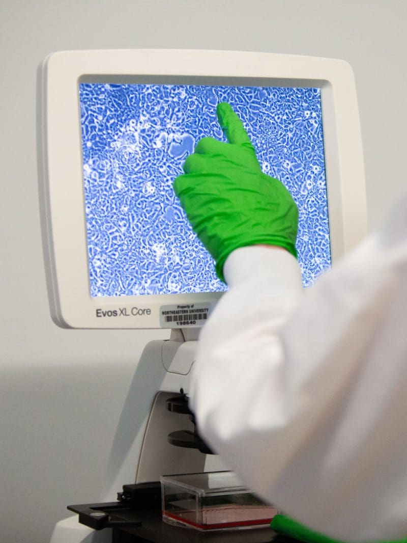 A hand in a green rubber glove pointing to cells on a magnifying glass screen